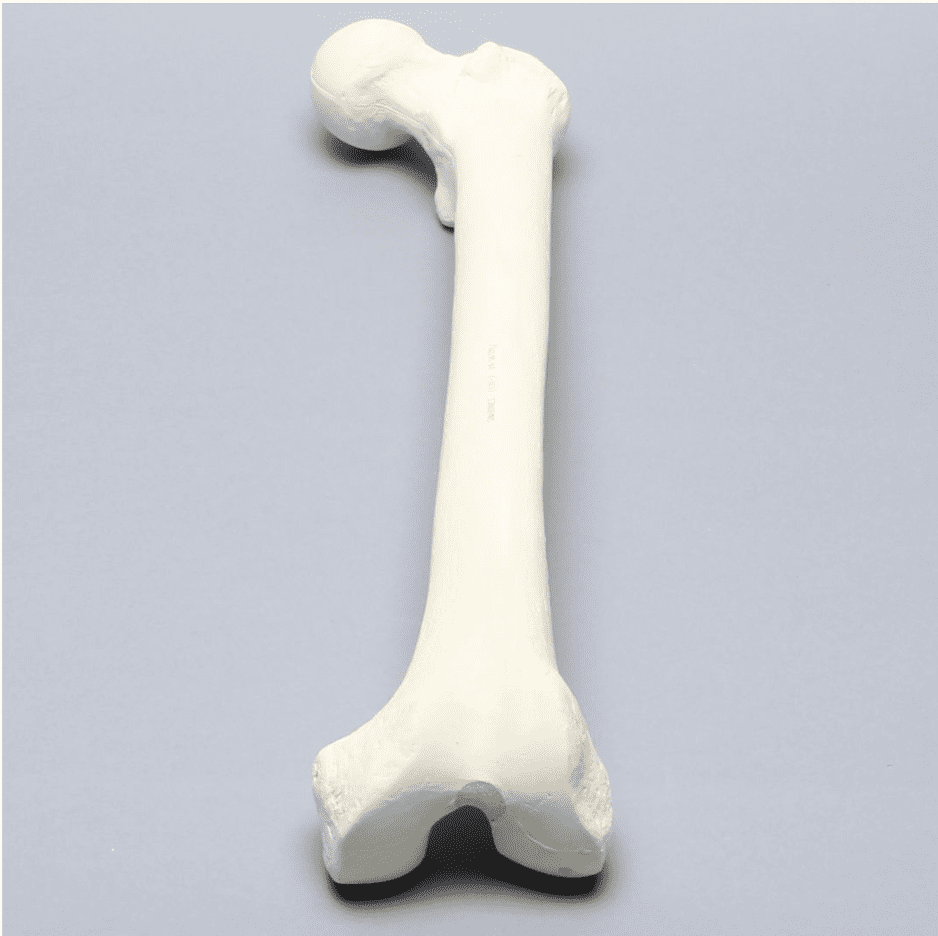 Femur with 17 mm Trochanteric Entry Site For IM Nail