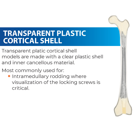 Clear Plastic Cortical Shell Model for Intramedullary Rodding with Visible Locking Screws
